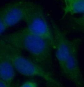 MIF Rabbit Polyclonal Antibody