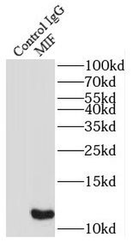 MIF Rabbit Polyclonal Antibody