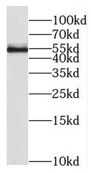 RIOX2 Antibody