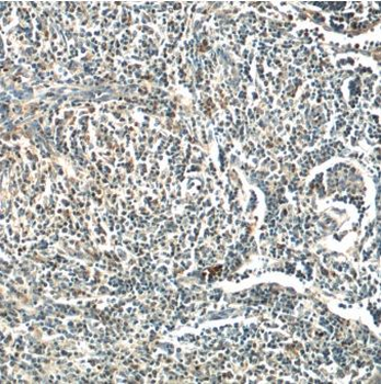 MINK1 Rabbit Polyclonal Antibody