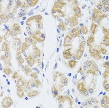 MIP Rabbit Polyclonal Antibody