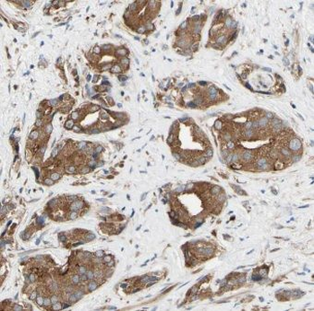 MIPEP Rabbit Polyclonal Antibody