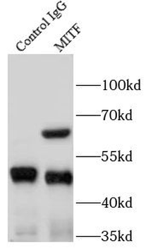MITF Rabbit Polyclonal Antibody