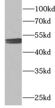 MAP2K7 Rabbit Polyclonal Antibody