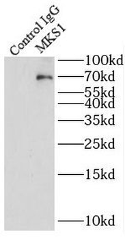 MKS1 Rabbit Polyclonal Antibody