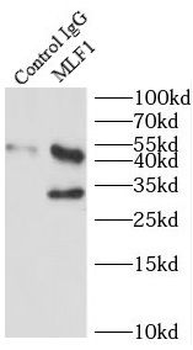 MLF1 Rabbit Polyclonal Antibody