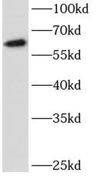 MAP3K11 Antibody