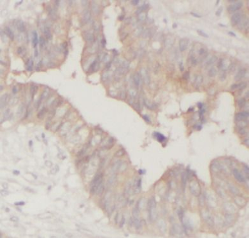 MAP3K11 Rabbit Polyclonal Antibody