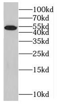 MAP3K21 Antibody
