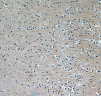 MAP3K21 Rabbit Polyclonal Antibody
