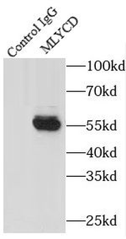 MLYCD Rabbit Polyclonal Antibody