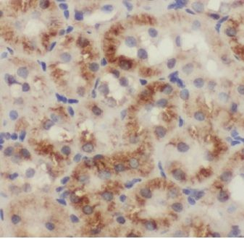 MLYCD Rabbit Polyclonal Antibody