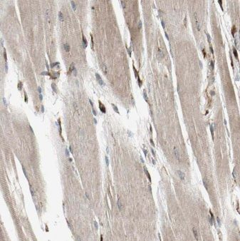 MMADHC Rabbit Polyclonal Antibody