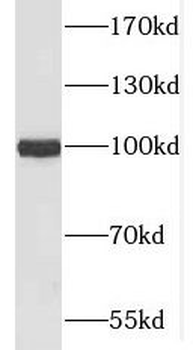 MME Rabbit Polyclonal Antibody