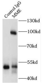 MME Rabbit Polyclonal Antibody