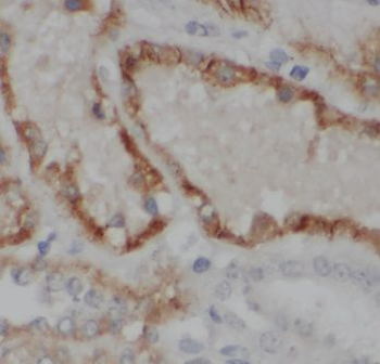 MME Rabbit Polyclonal Antibody
