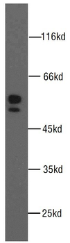 MMP1 Rabbit Polyclonal Antibody