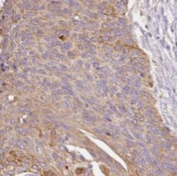 MMP1 Rabbit Polyclonal Antibody
