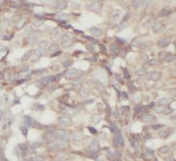 MMP13 Rabbit Polyclonal Antibody