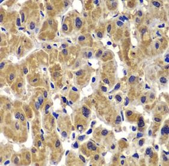 MMP14 Rabbit Polyclonal Antibody