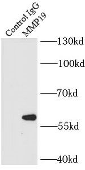MMP19 Rabbit Polyclonal Antibody