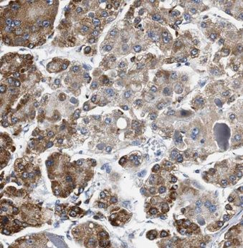 MMP19 Rabbit Polyclonal Antibody