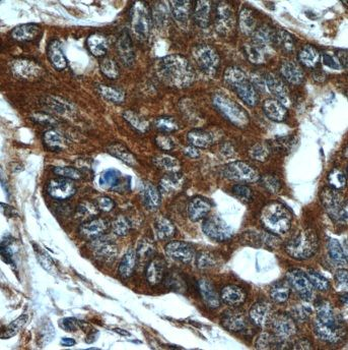 MMP21 Rabbit Polyclonal Antibody