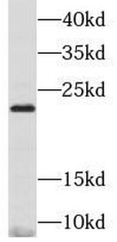 MMP26 Rabbit Polyclonal Antibody