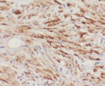 MMP26 Rabbit Polyclonal Antibody