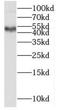 MMP28 Rabbit Polyclonal Antibody