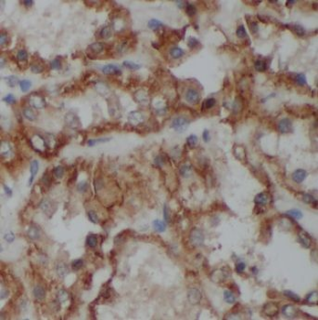 MMP28 Rabbit Polyclonal Antibody