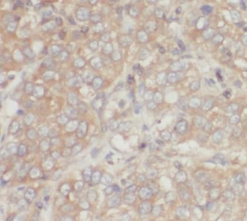 MMP3 Rabbit Polyclonal Antibody