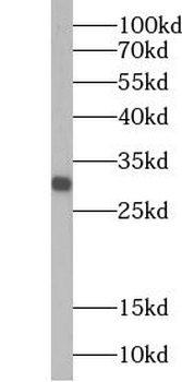 MMP7 Rabbit Polyclonal Antibody