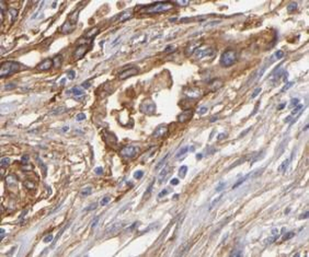 MMP7 Rabbit Polyclonal Antibody