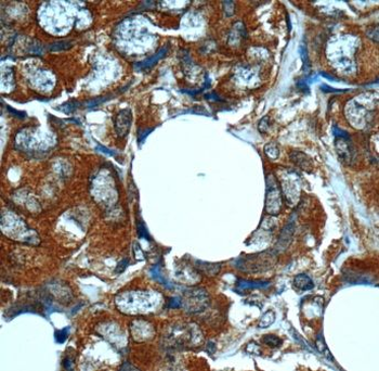 MN1 Antibody