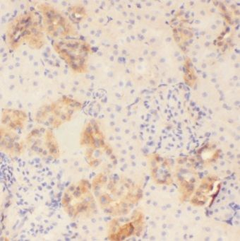MOGAT2 Rabbit Polyclonal Antibody