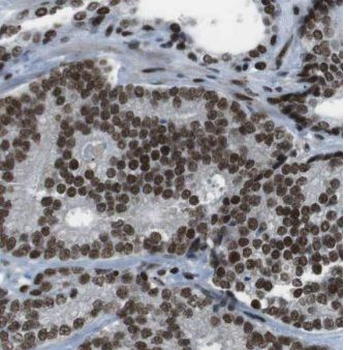 MOV10 Rabbit Polyclonal Antibody