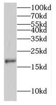 MPHOSPH6 Antibody