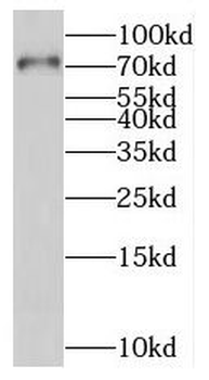 PALS1 Antibody