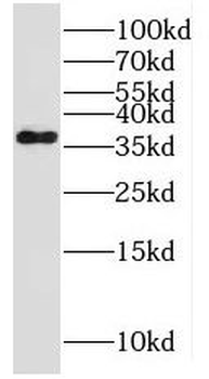 MPPED1 Antibody