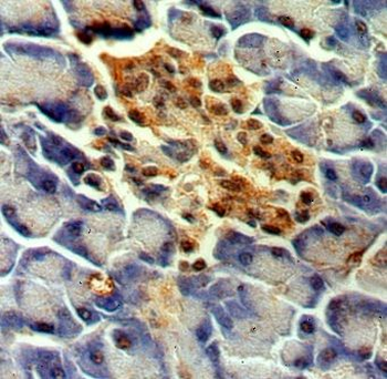 MPPED1 Rabbit Polyclonal Antibody