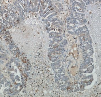 ABCC5 Antibody