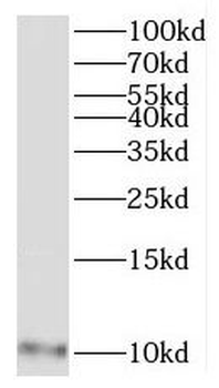 MRPL27 Rabbit Polyclonal Antibody