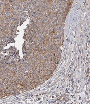 MRPL3 Rabbit Polyclonal Antibody