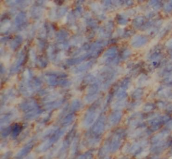 MRPL34 Rabbit Polyclonal Antibody