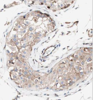 MRPL36 Antibody