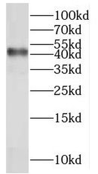 MRPL38 Rabbit Polyclonal Antibody