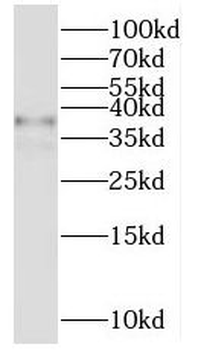 MRPL44 Rabbit Polyclonal Antibody