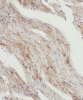 MRPL46 Rabbit Polyclonal Antibody