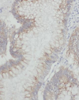 MRPL55 Rabbit Polyclonal Antibody